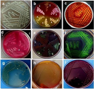 Phenotypic and Molecular Characterization of Bovine Mastitis Milk Origin Bacteria and Linkage of Intramammary Infection With Milk Quality